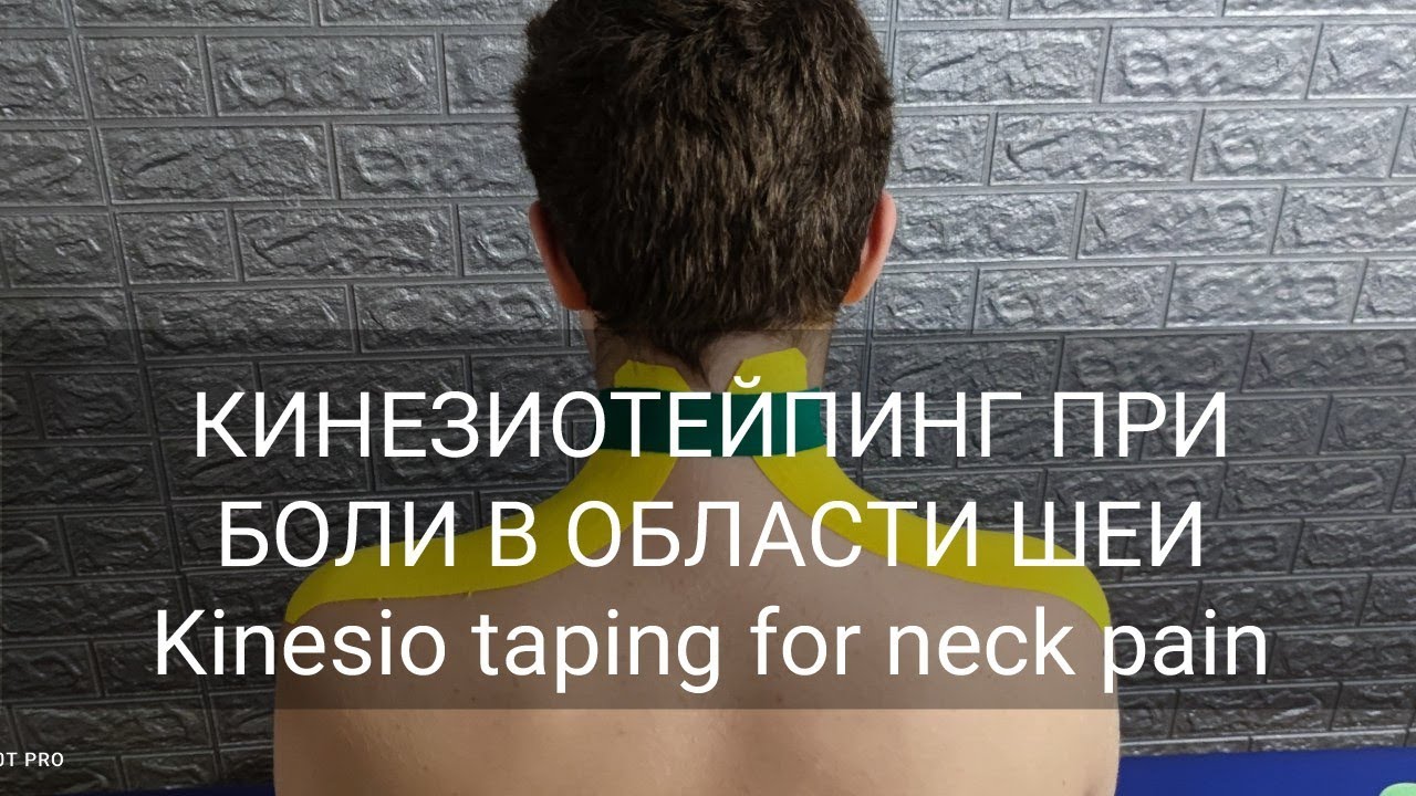 КИНЕЗИОТЕЙПИНГ ПРИ БОЛИ В ОБЛАСТИ ШЕИ/ Kinesio taping for neck pain