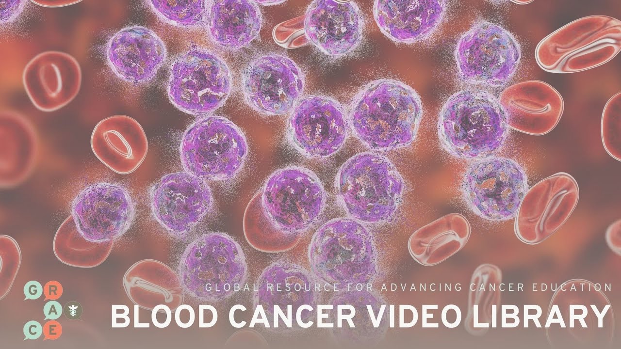 CAR T-Cell Therapy Patients with Relapsed Diffuse Large B-Cell Lymphoma - Blood Cancer Video Library