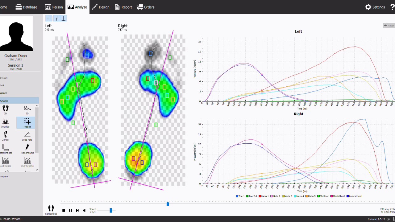 Pressure analysis at the Buchanan Clinic