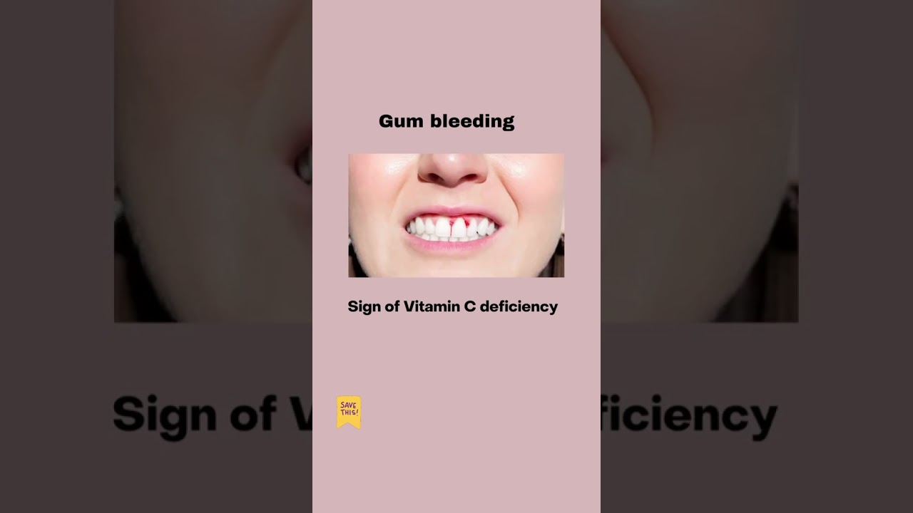 Do You Notice These Symptoms ?