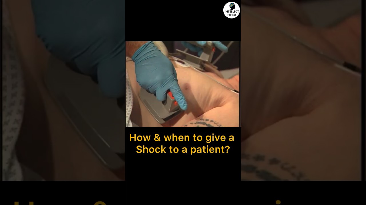 Defibrillator shock (How & When to give) #icu #emergency #cardiology
