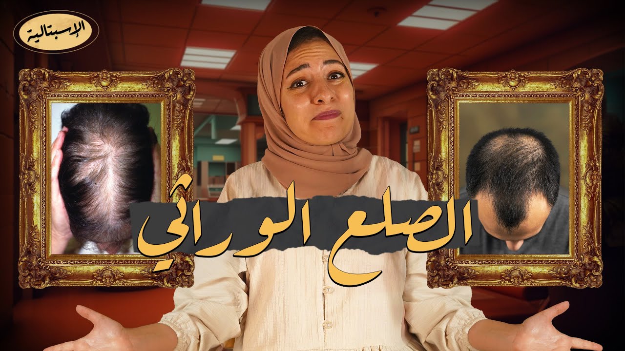 الصلع الوراثي | هتودع شعرك إمتى ؟ | الاسبتالية