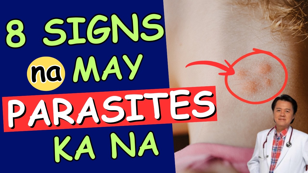 8 Signs na May Parasites Ka Na.-  By Doc Willie Ong
