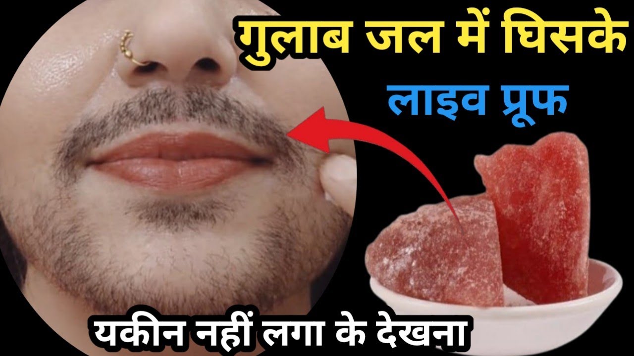 सिर्फ दो बूंद में भाभी जी के चेहरे से दाढ़ी मूछ ऐसे साफ प्रूफ देखो😱|| facial hair removal for women