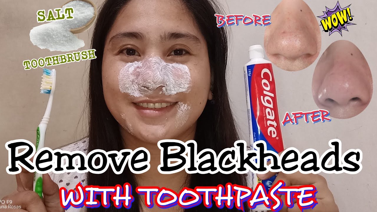 Удаление черных точек с помощью зубной пасты и соли своими руками: избавьтесь от черных точек с п...