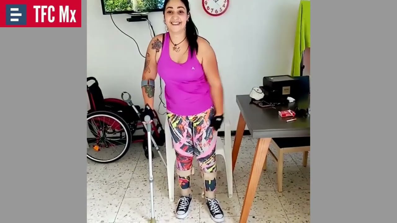 Terapia Física - Lesión medular Fístula arteriovenosa