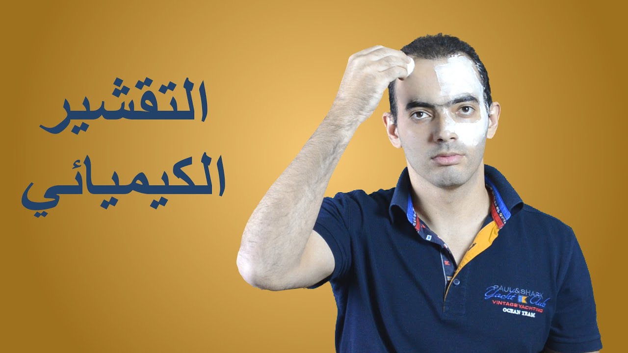 التقشير الكيميائي - د. محمد الناظر