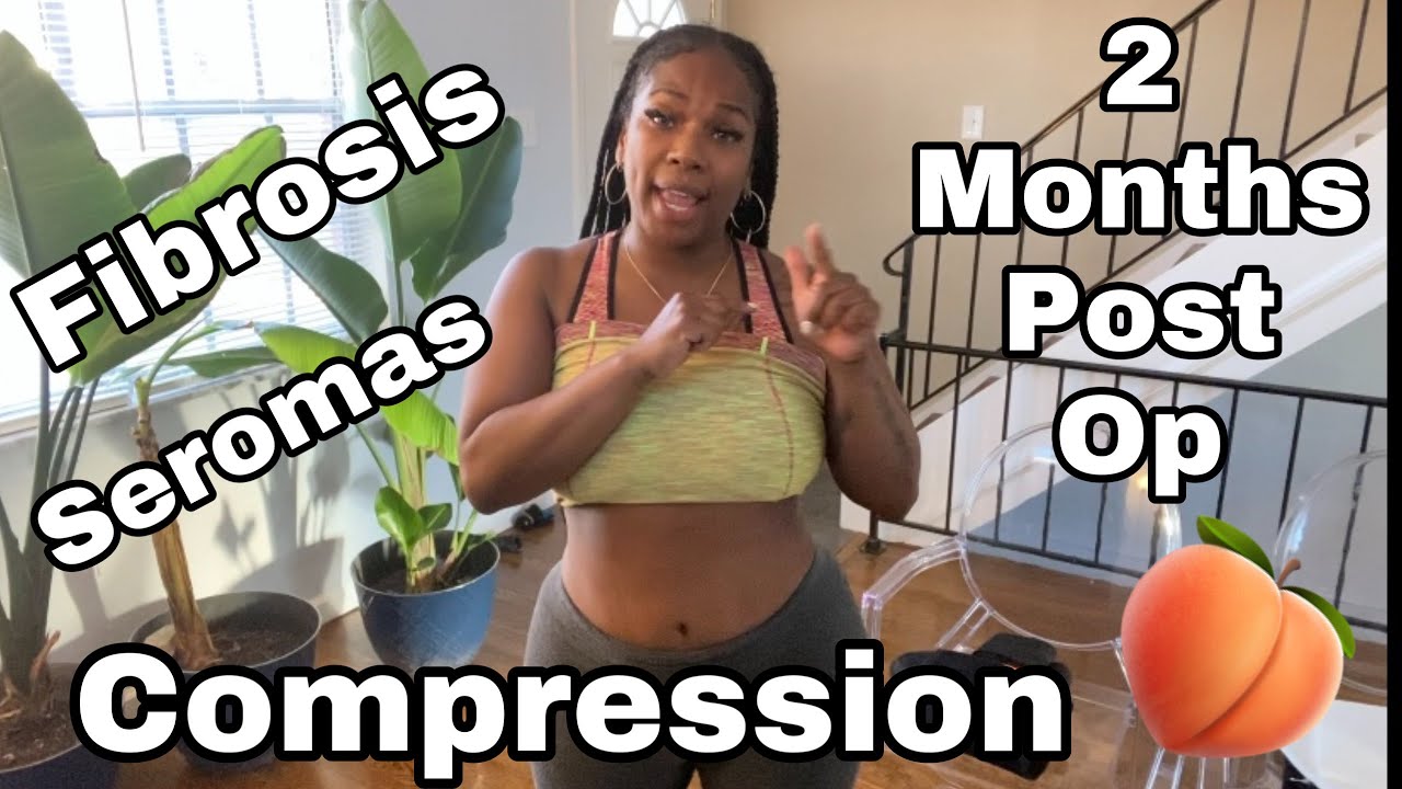 2MPO #BBL & GOODBYE #FAJA | TREATING MY FIBROSIS | HOW I COMPRESS | #SEROMA | #NEWLIFECOSMETICS