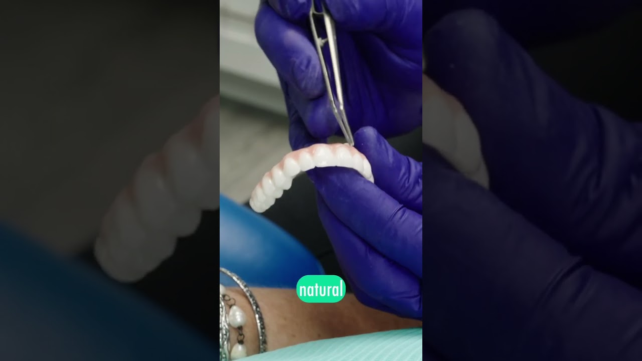Why Zirconia + Porcelain Make the Most Natural Smile | Houston Periodontist | Dental Implants
