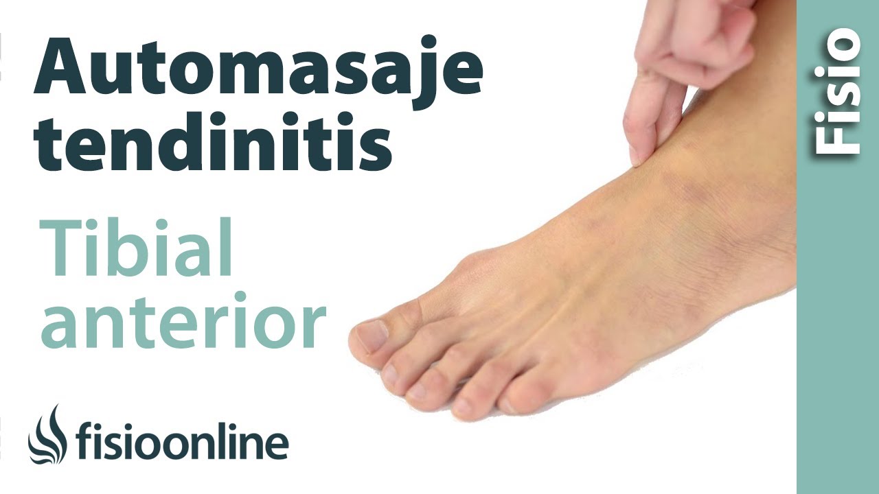 Tendinitis del tibial anterior - Automasaje para su tratamiento