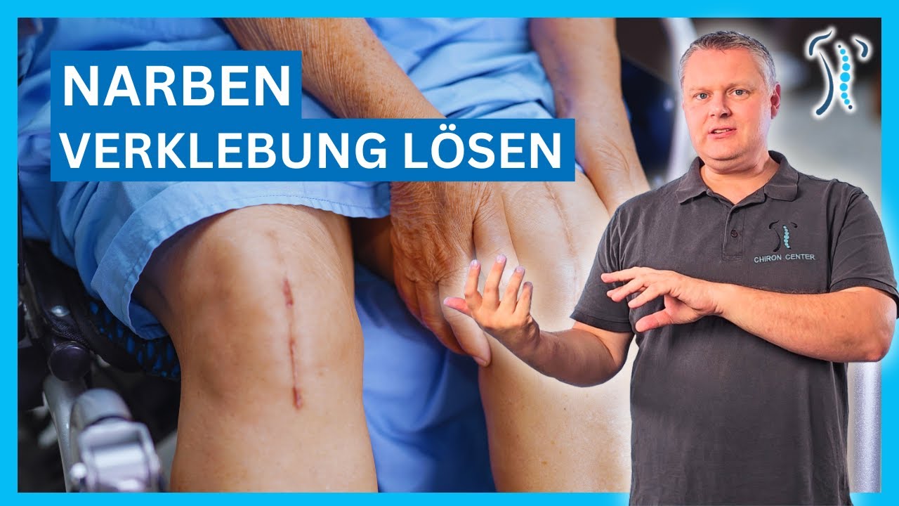 Narben-Verklebungen selber lösen - Welche Techniken es gibt