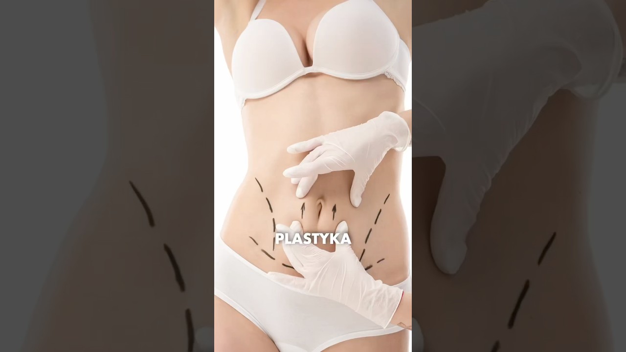 Plastyka brzucha a pępek ✨