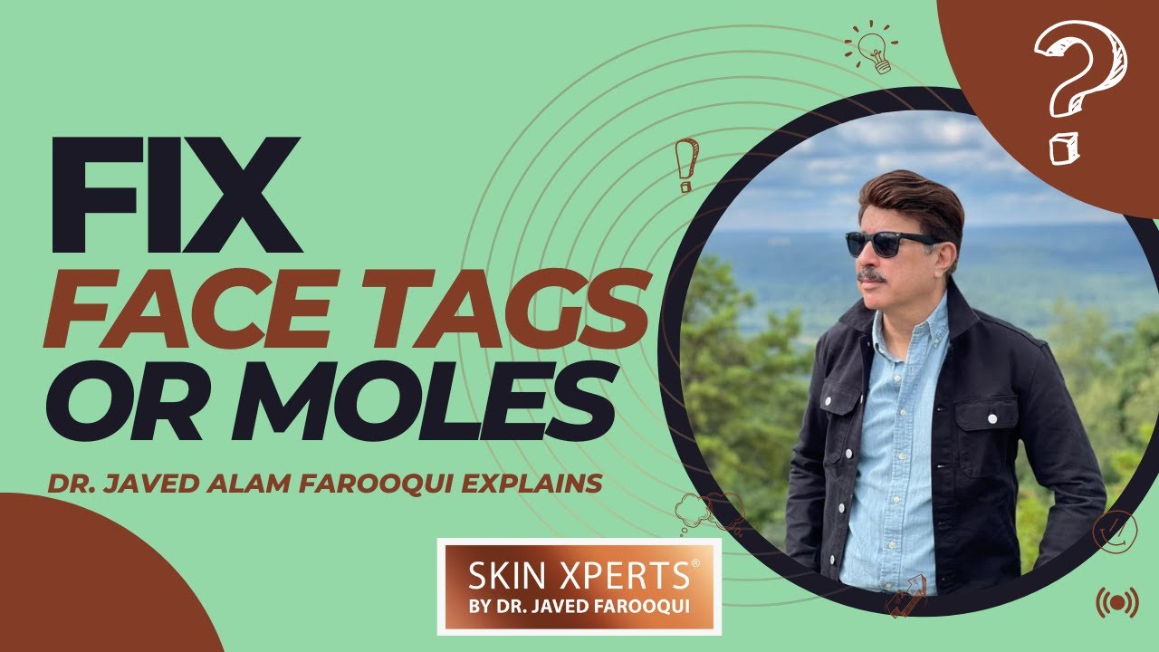 Fix Face Tags ‏‏مسے (Warts)| Don't Do This EVER | Dr. Javed Alam Farooqui #skincare #dermatologist