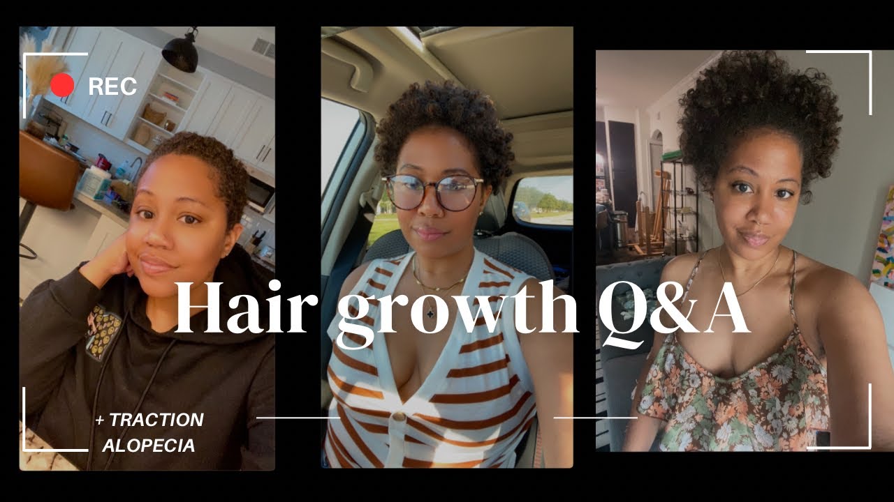 Hair Growth Q&A (how to grow hair plus info on traction alopecia)