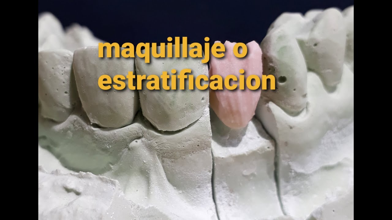 Estratificar o maquillar zirconio como estructura restauración dental noritake czr