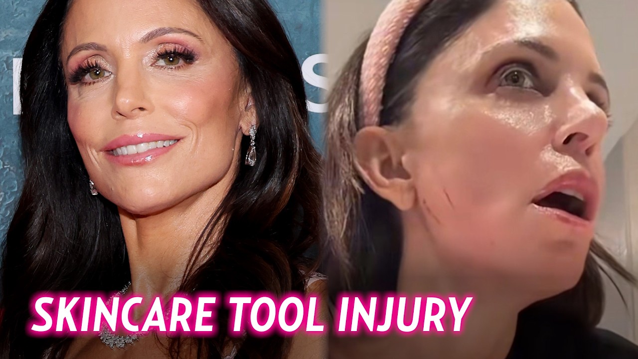 Bethenny Frankel Cuts Her Face Open With Skincare Product