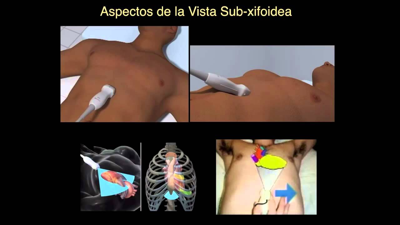 Exploración ecocardiográfica en urgencias