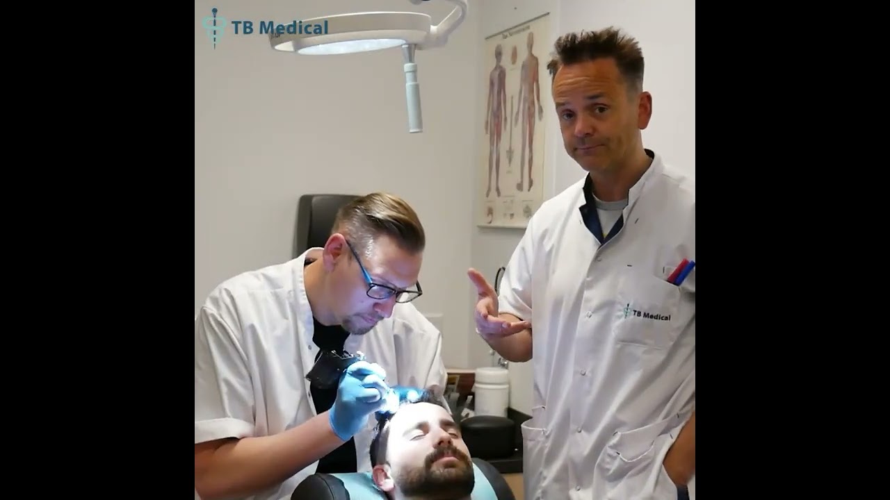 Je eigen haar opvullen met micro haar pigmentatie ofwel stoppeltattoo tegen kaalheid.