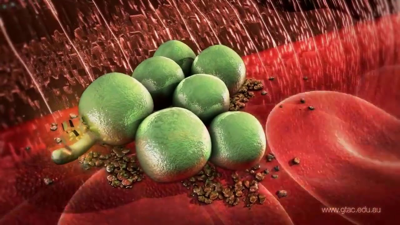 video t&eacute;tano equino - Patologia general