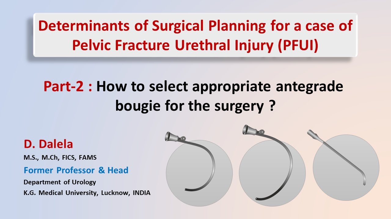 Какой антеградный буж использовать для реконструкции повреждения уретры после перелома таза?