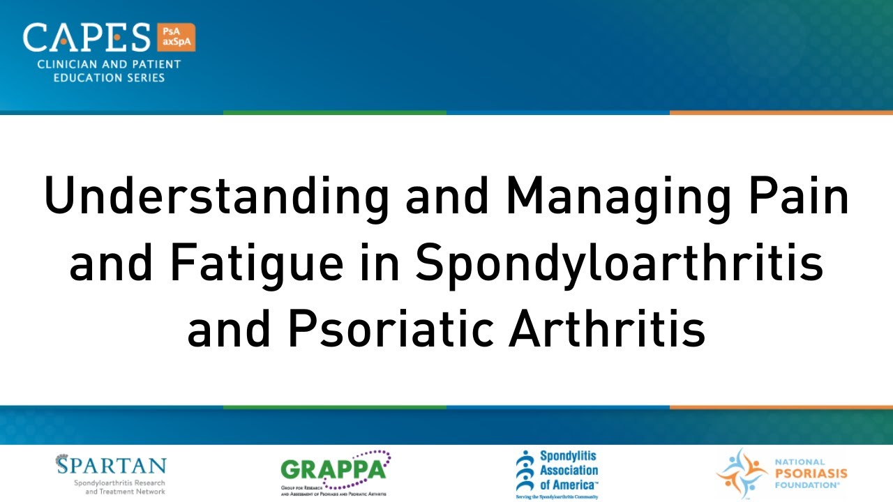 Understanding and Managing Pain and Fatigue in Spondyloarthritis and Psoriatic Arthritis