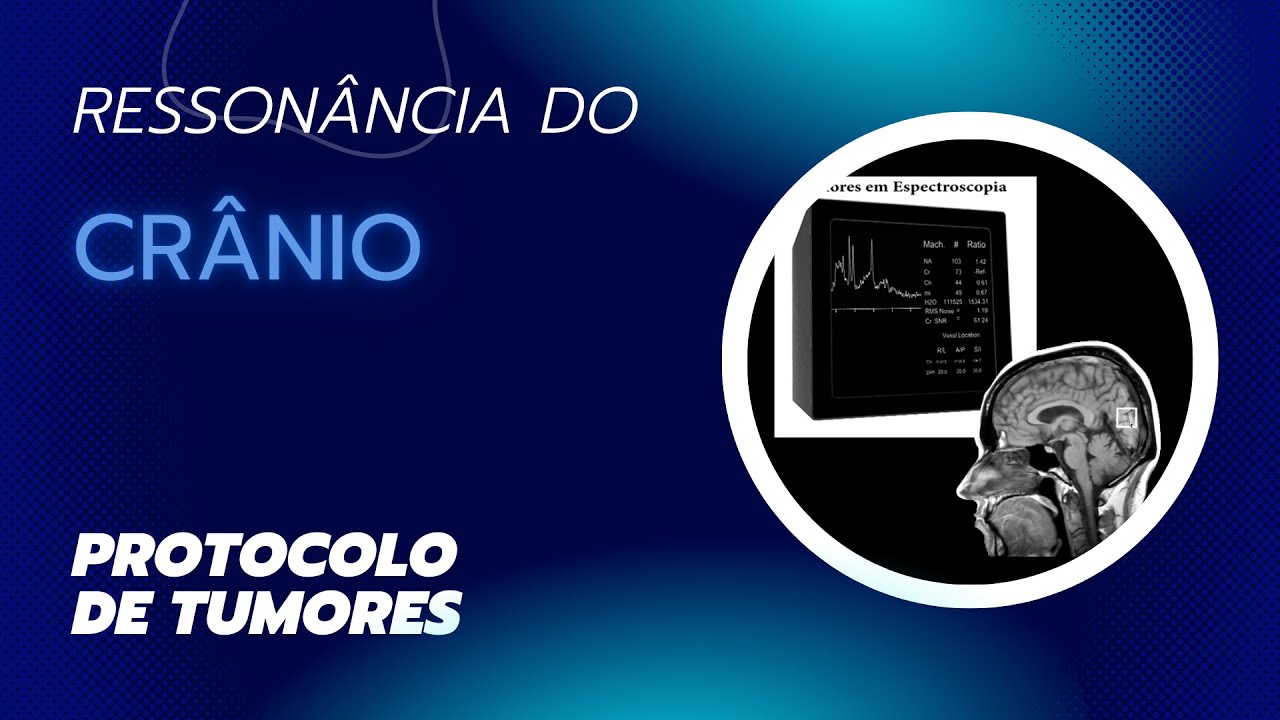 Planejamento de Exames em Ressonância Magnética