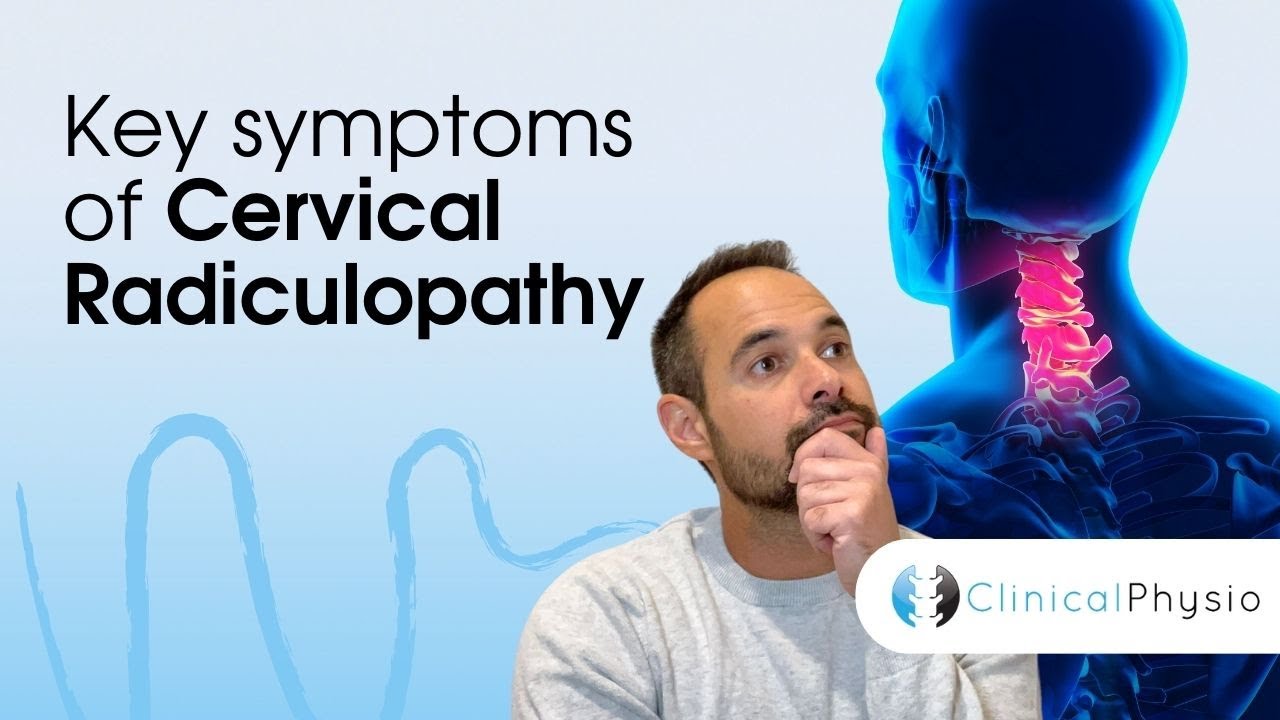 Key Symptoms of Cervical Radiculopathy | Expert Physio Guide