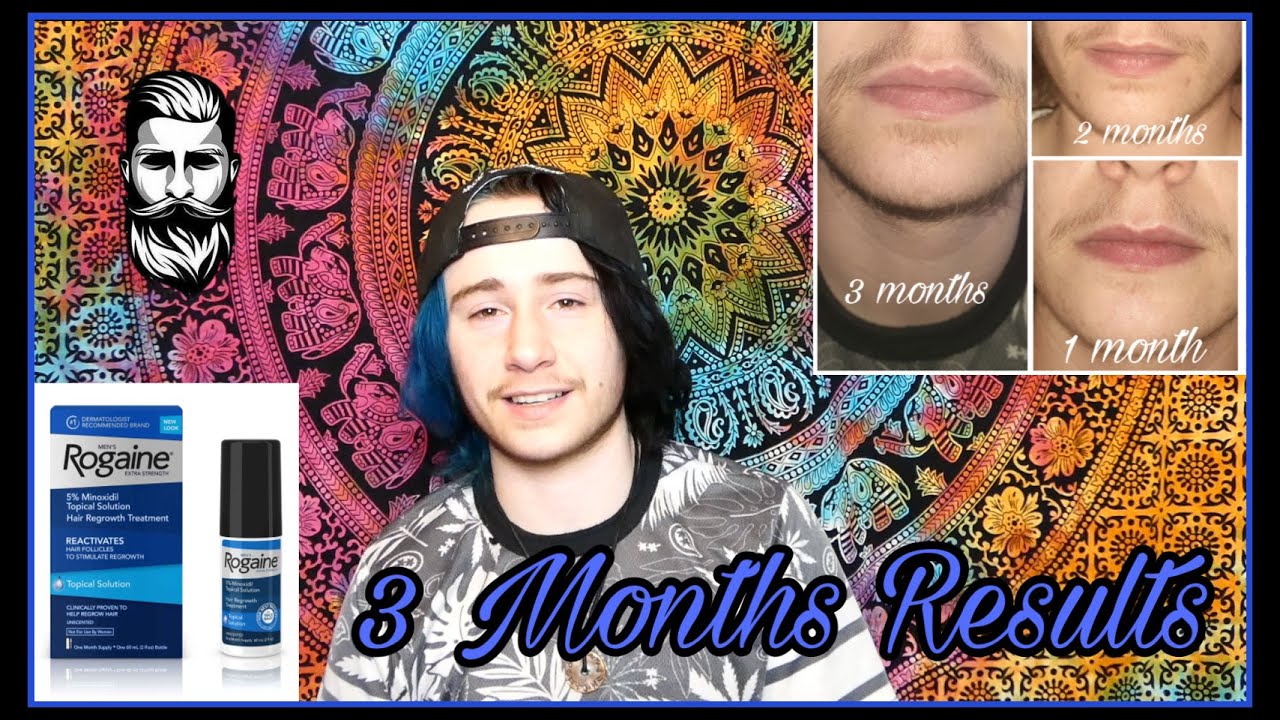 3 Months on Minoxidil Results // FTM Beard Growth Tips and Tricks