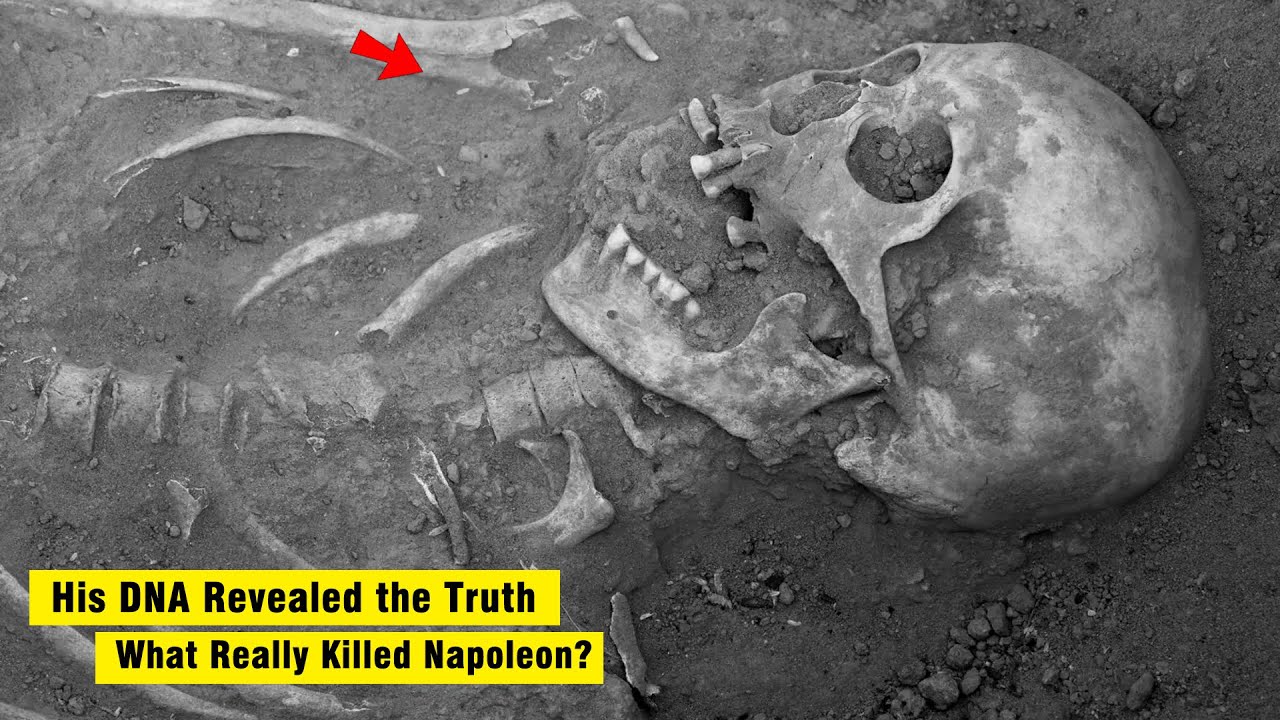 Napoleon's Death Revealed: DNA Analysis Confirms It WASN'T Poison!