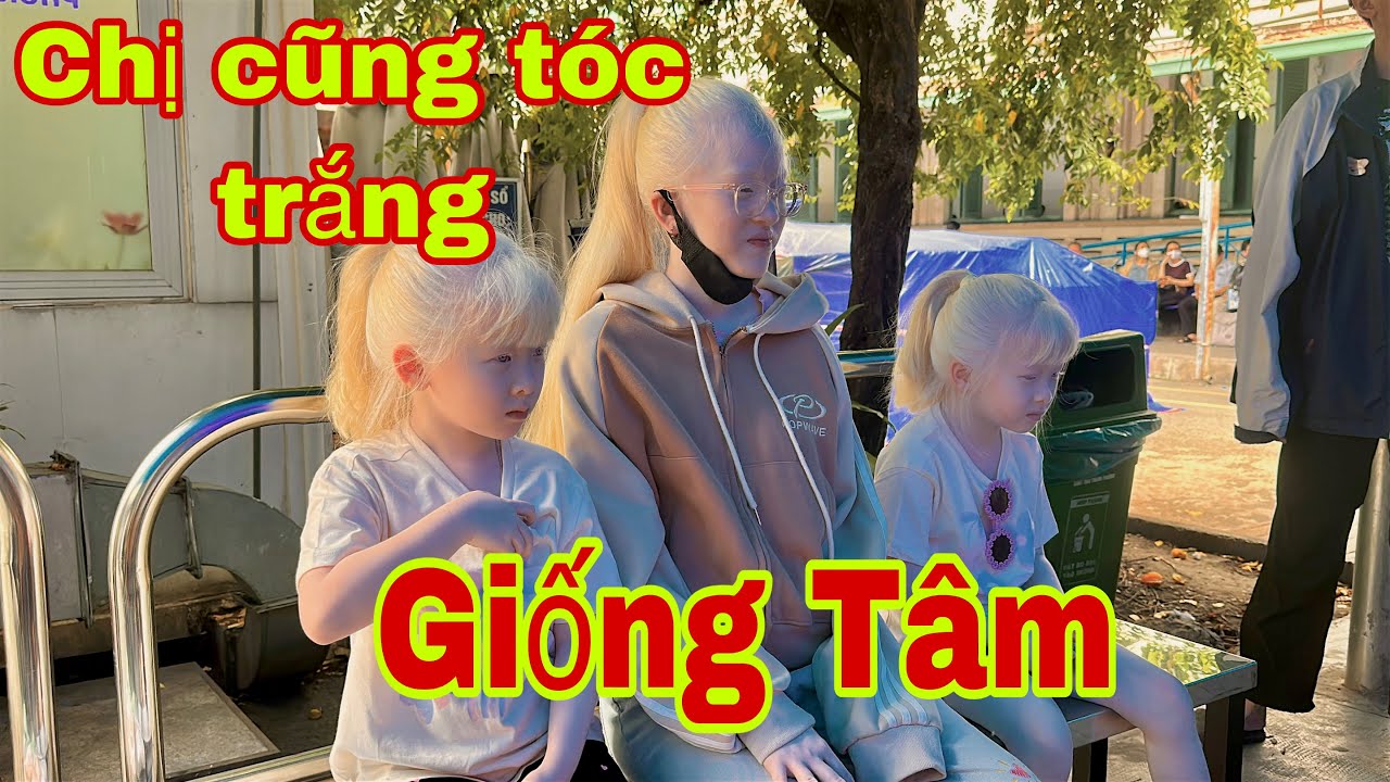 Đi khám mắt bất ngờ gặp chị tóc trắng dễ thương giống như Tâm Tâm - SONG SINH THIÊN THẦN 