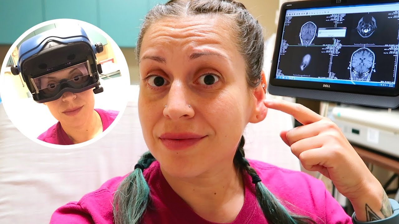 VNG and MRI Results /What's causing my dizziness?