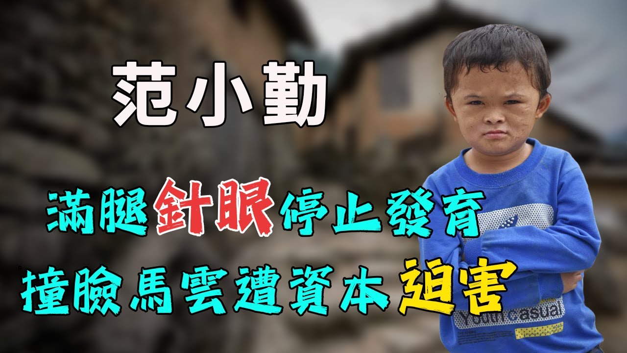 小馬雲過氣被解約，曾經美女保姆不離身，被丟棄農村後雙腿驚現恐怖針眼！