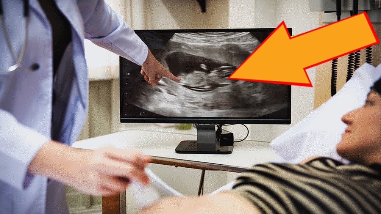 A Woman Gave Birth to Semi-Identical Twins, and Doctors Were Left Totally Perplexed