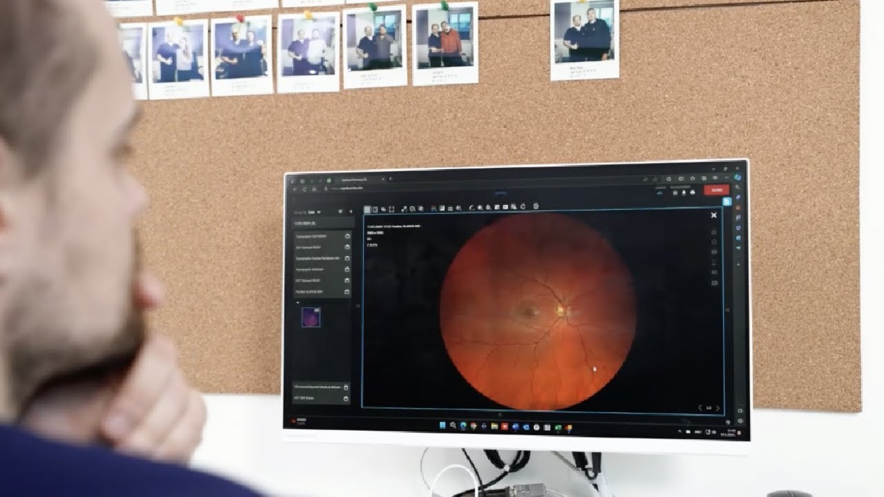 Topcon Healthcare | Svjetlost Eye Clinic x Harmony