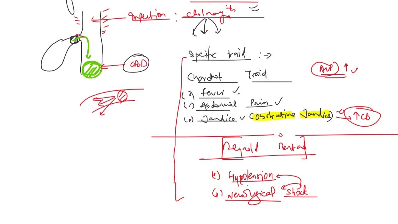 Ascending cholangitis and Gall Stone ileus Made Easy | Usmle step 1| #speedymedical