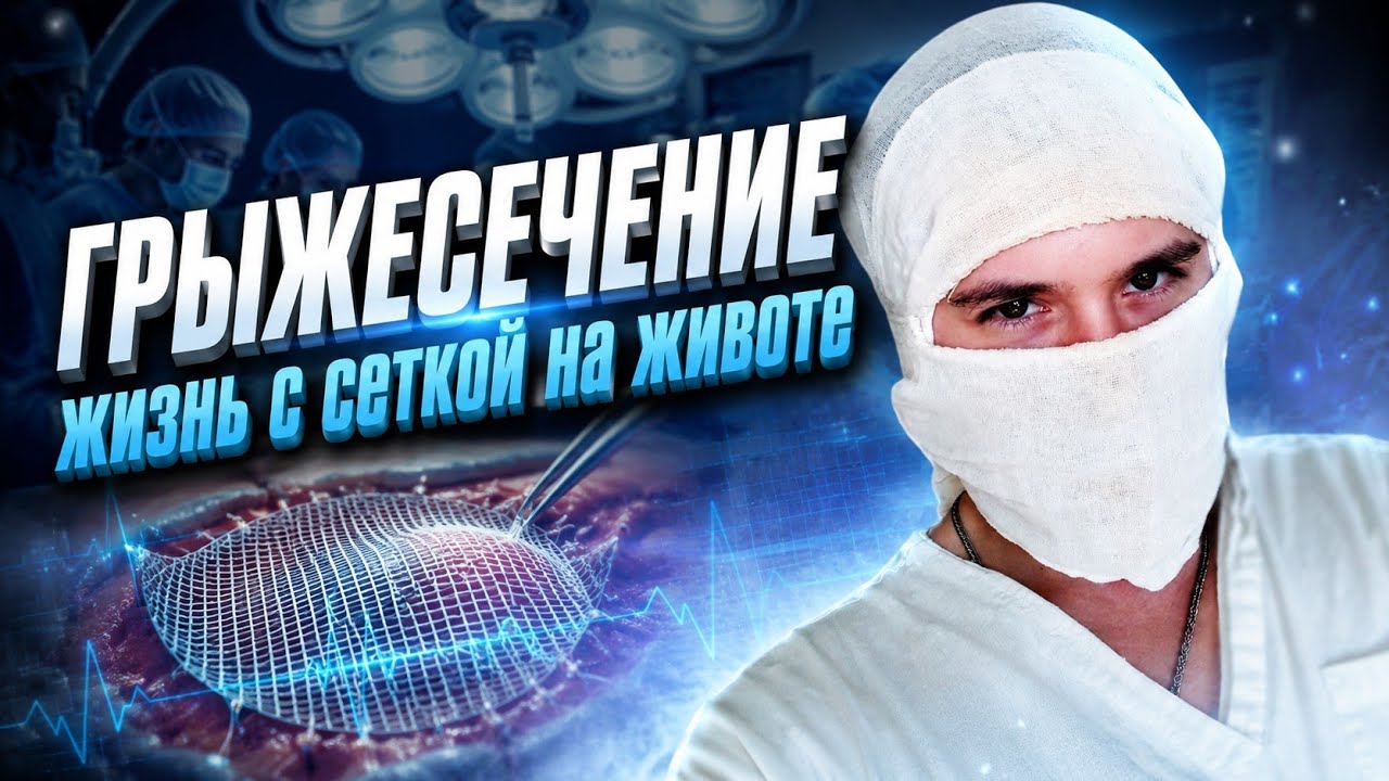 Грыжесечение | Жизнь с сеткой на животе