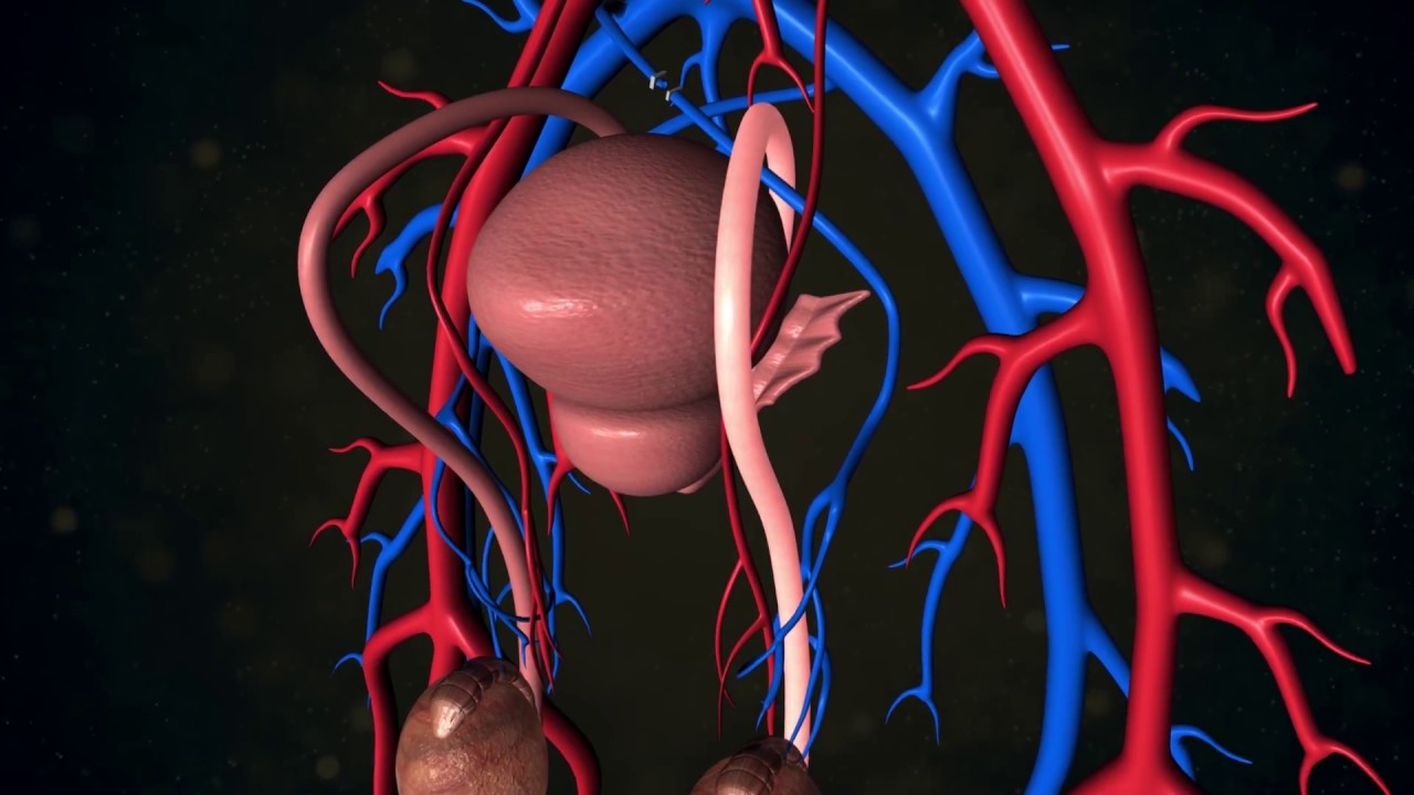Varicocele Repair - Reproductive Specialists Advanced Infertility Treatments