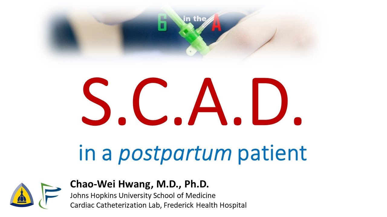 Spontaneous Coronary Artery Dissection (SCAD) in a postpartum patient