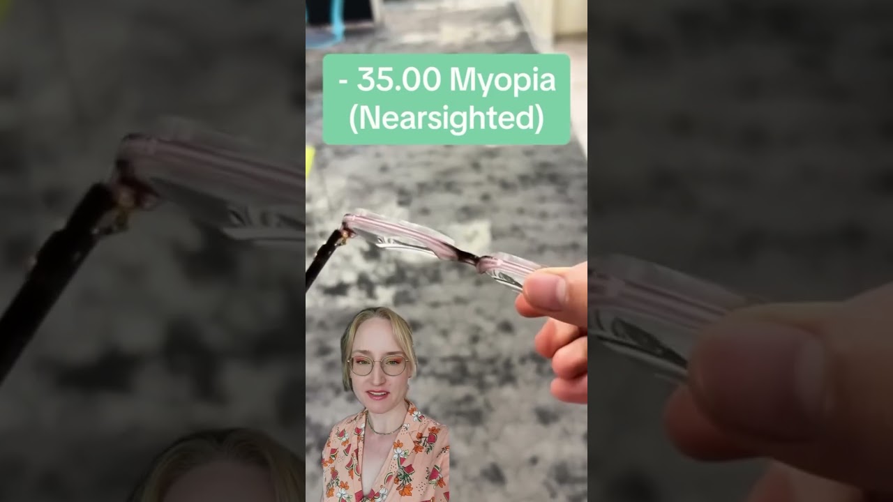 Une myopie &agrave; -35 WOW ! 😲👓