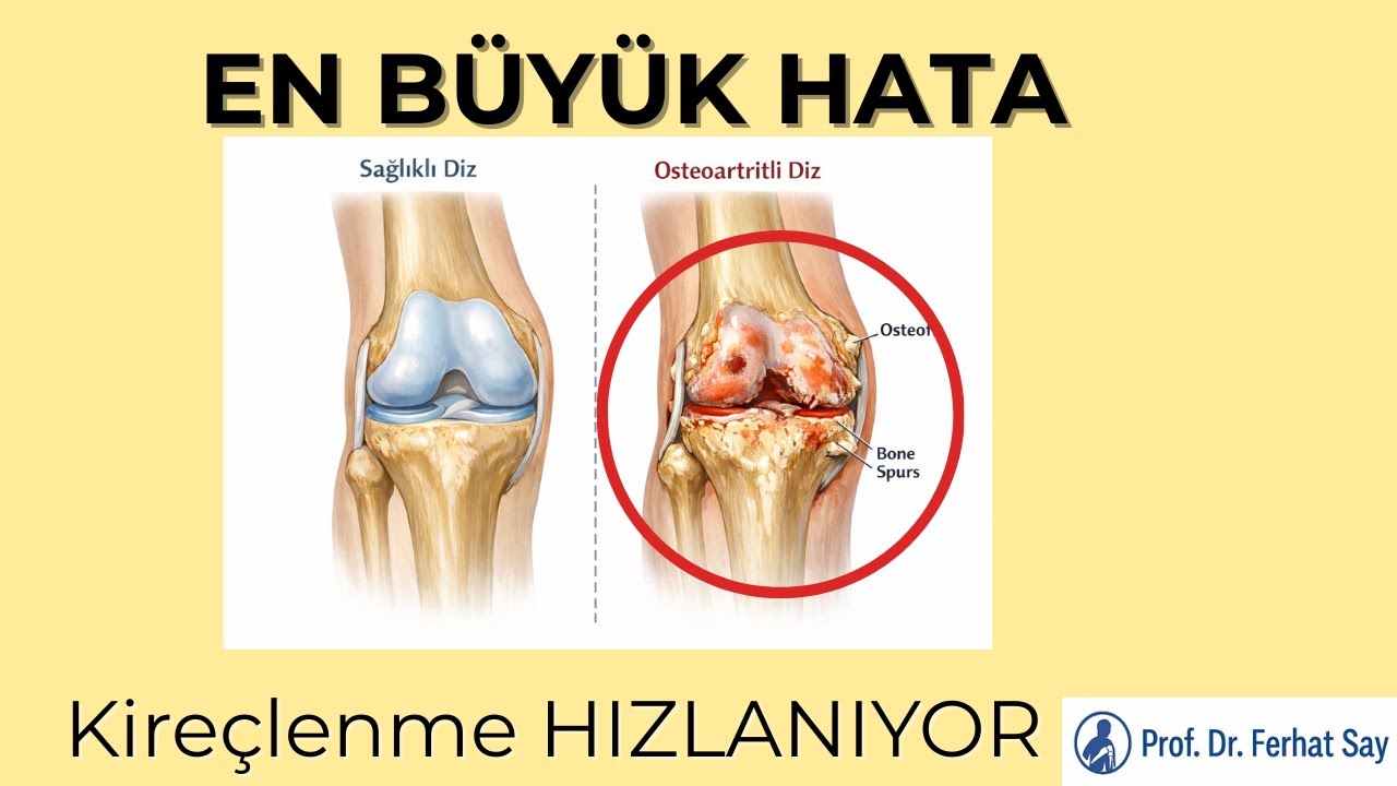 Diz Kireçlenmesinde En Büyük Hata | Kireçlenme Neden Hızlanır?