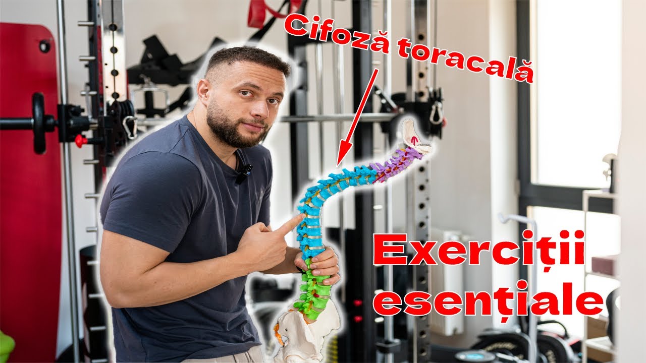 EXERCITII PENTRU CIFOZA ( COCOASA ) INDREAPTA-TI POSTURA INSTANT !