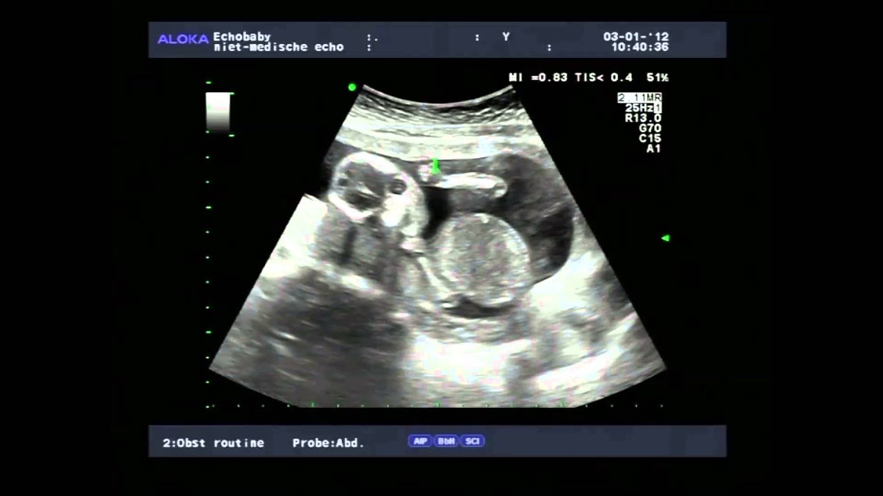 16 Weken Zwangerschap, met ingesproken uitleg