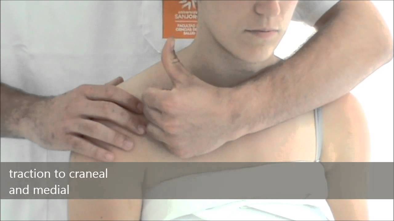 TRATAMIENTO DE LA ARTICULACION ACROMIOCLAVICULAR