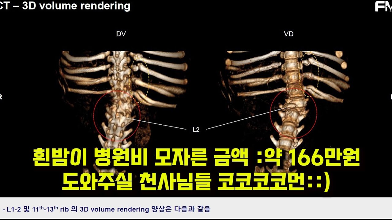 흰밤이 수술 무사히 잘 끝냈습니다 / 예상 병원비 부족한 금액 약 166만원 / 도와주실 천사님들 코코코코먼::)
