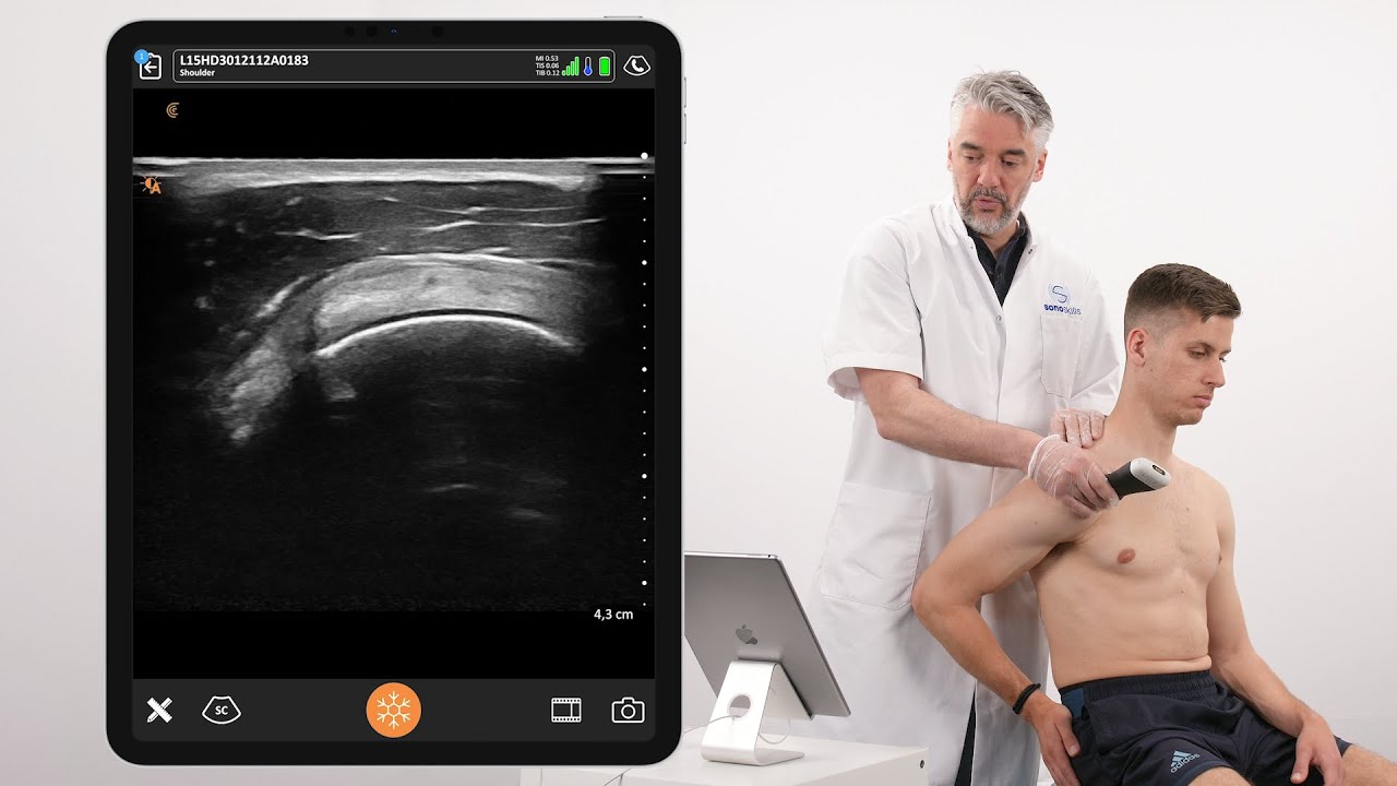 Dynamic Assessment of Ligaments of the Coracoid Process, and Supraspinatus Tendon