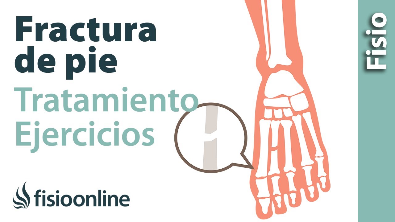 Rehabilitación de fracturas del pie con ejercicios, automasajes y estiramientos