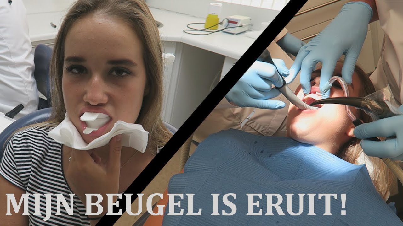MIJN BEUGEL IS ERUIT!