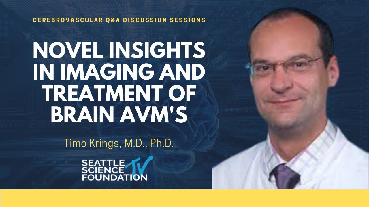 Novel Insights in Imaging and Treatment of Brain AVM’s –  Timo Krings, M.D.