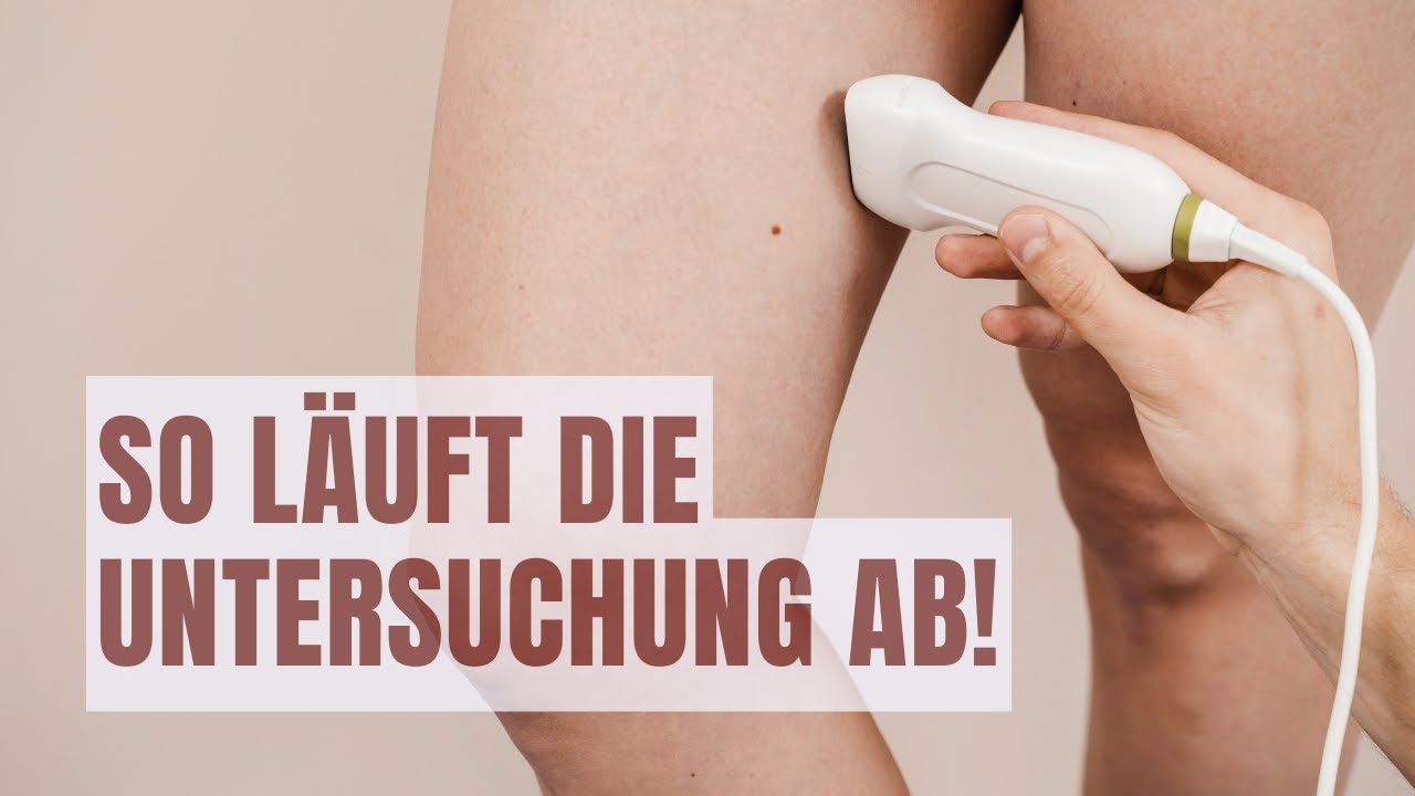 DEIN BESUCH beim Gefäßchirurgen: So läuft die UNTERSUCHUNG Schritt für Schritt ab! | Dr. Sabetian