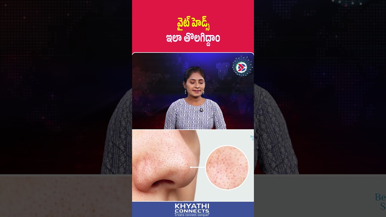 వైట్‌ హెడ్స్‌ ఇలా తొలగిద్దాం | Whitehead Removal Tips for Clear Skin | Beauty Hacks | Andhara